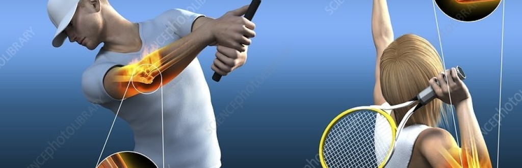 Preventing Tennis Injuries